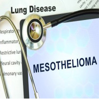 Philadelphia Mesothelioma Lawyers discuss a Rise in Number of Mesothelioma Deaths