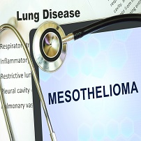 Philadelphia mesothelioma lawyers represent victims of illnesses caused by asbestos.
