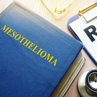 Philadelphia Mesothelioma Lawyers  Biomarkers and Testing