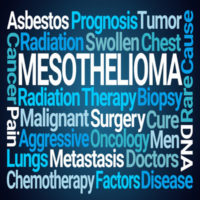 Philadelphia mesothelioma attorneys defend those exposed to asbestos and discuss common mesothelioma symptoms.