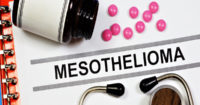 Philadelphia mesothelioma lawyers advocate for victims diagnosed with mesothelioma